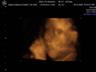 Posted by wanderingleaf0 on 2/15/2007, 18KB
this is a 4d scan of my granson to be