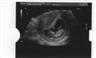 Posted by McHussy7 on 12/3/2007, 17KB
My first view of my first grandchild, and I am sure it will be a girl.